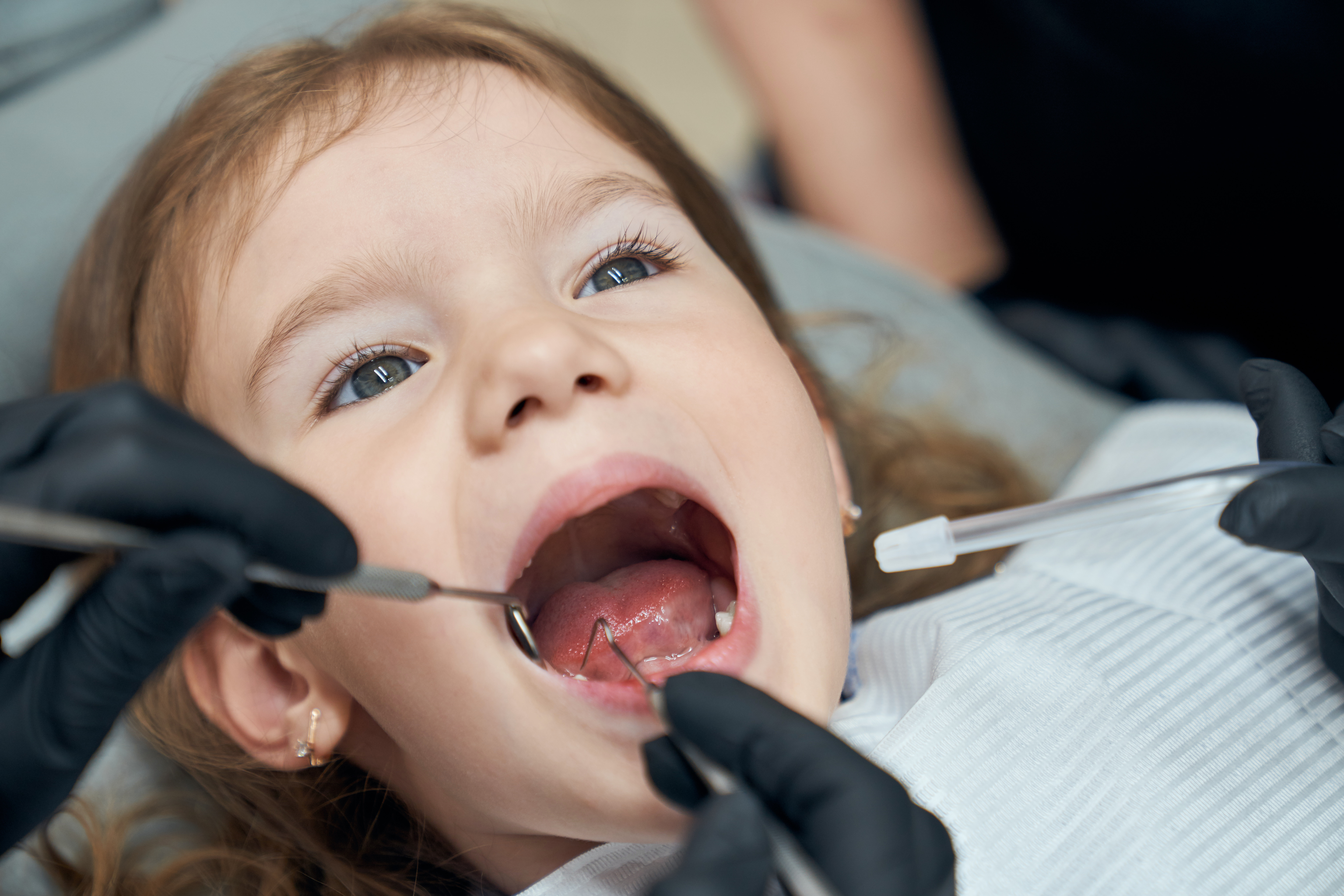 Early Childhood Caries