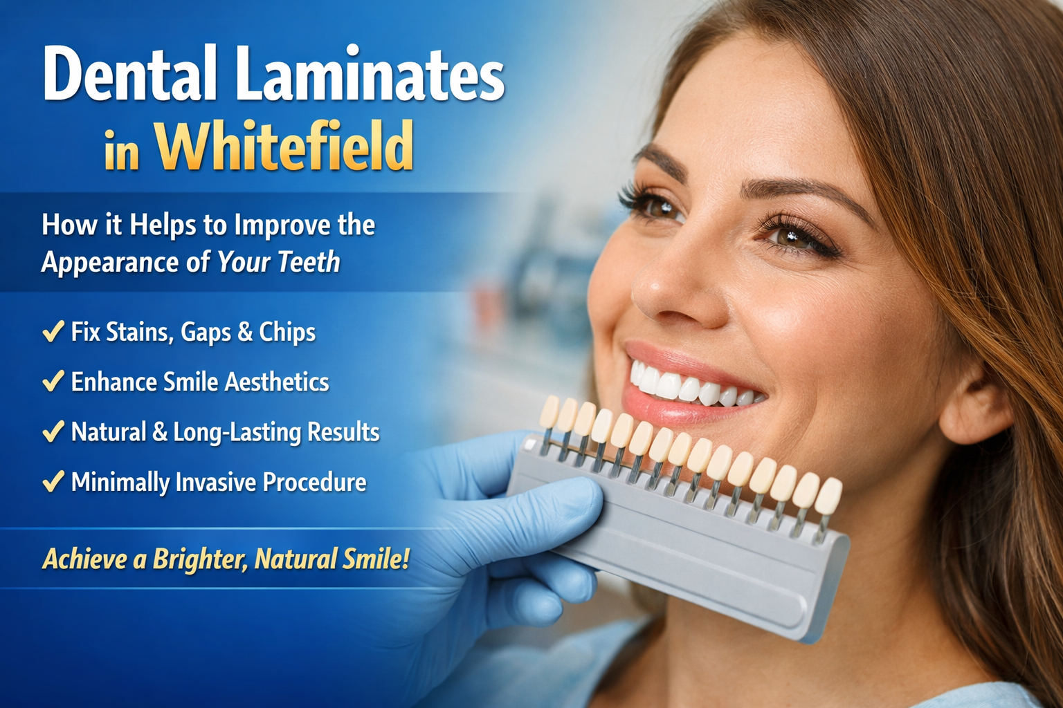 Dental Laminates