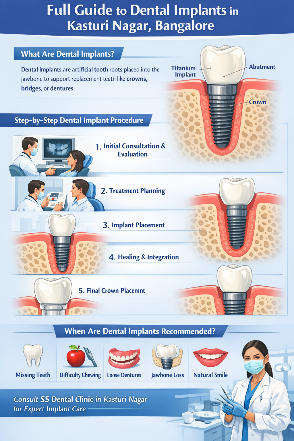 Dental Implants