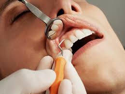 Preventive Dentistry