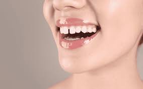 Teeth Spacing Treatment