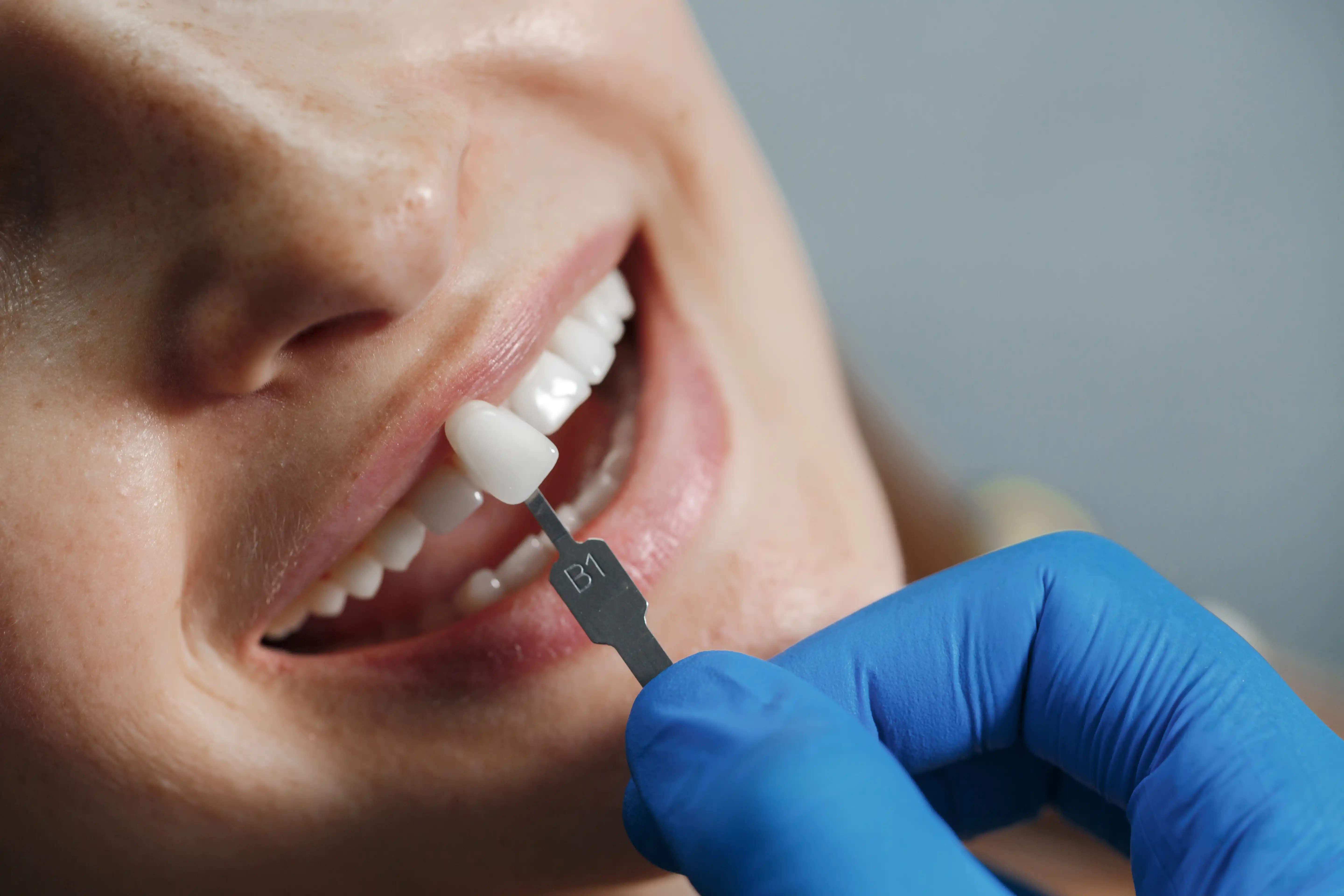 Bridges Dentistry