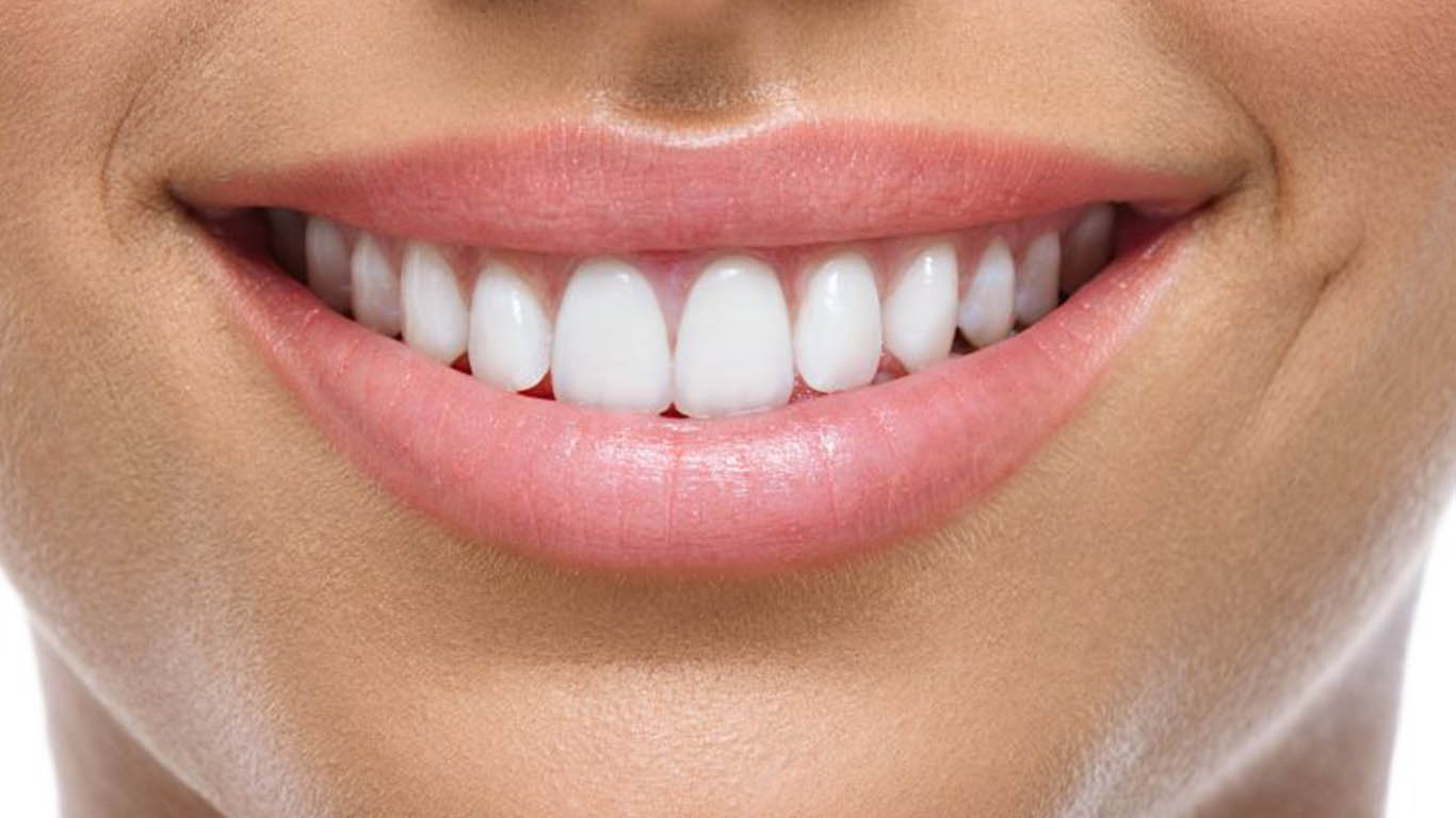 Teeth Whitening